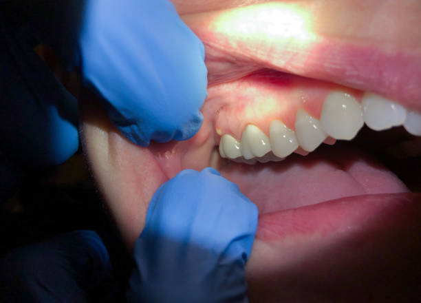 Best Cracked Tooth Emergency Dentist  in Messiah College, PA
